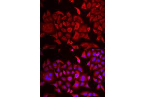Immunofluorescence analysis of HeLa cells using TARS antibody (ABIN6132713, ABIN6148858, ABIN6148859 and ABIN6222758). (TARS 抗体  (AA 1-230))