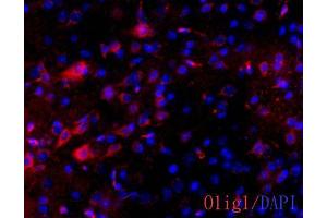 IHC-Fr Image OLIG1 antibody [C2C3] detects OLIG1 protein on adult mouse brain by immunohistochemical analysis. (OLIG1 抗体  (C-Term))