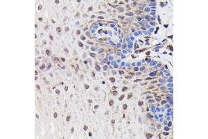 Immunohistochemistry (IHC) image for anti-Phosphoinositide 3 Kinase, p85 beta (PI3K p85b) antibody (ABIN1679407)