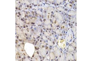 Immunohistochemistry of paraffin-embedded rat pancreas using IRF6 antibody at dilution of 1:200 (400x lens). (IRF6 抗体)
