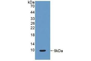 Detection of Recombinant CC16, Human using Polyclonal Antibody to Clara Cell Protein 16 (CC16) (SCGB1A1 抗体  (AA 23-91))
