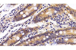 Detection of EPCAM in Porcine Small intestine Tissue using Polyclonal Antibody to Epithelial Cell Adhesion Molecule (EPCAM)