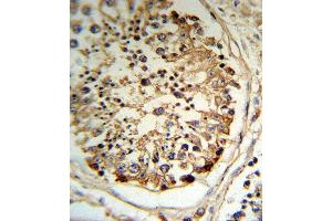 T Antibody (Center) (R) IHC analysis in formalin fixed and raffin embedded human testis tissue followed by peroxidase conjugation of the secondary antibody and DAB staining. (PLAT 抗体  (AA 371-399))