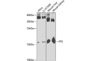 Western blot analysis of extracts of various cell lines, using PTS antibody (ABIN6129844, ABIN6146483, ABIN6146485 and ABIN6221911) at 1:1000 dilution. (PTS 抗体  (AA 1-145))