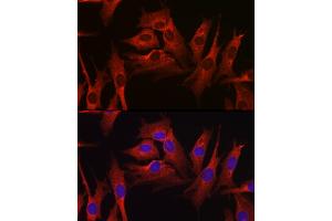 Immunofluorescence analysis of NIH-3T3 cells using HMGCR Rabbit pAb (ABIN3022293, ABIN3022294, ABIN3022295, ABIN1513022 and ABIN6218714) at dilution of 1:100 (40x lens). (HMGCR 抗体  (AA 629-888))