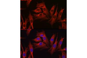 Immunofluorescence analysis of NIH-3T3 cells using HMGCR Rabbit pAb (ABIN3022293, ABIN3022294, ABIN3022295, ABIN1513022 and ABIN6218714) at dilution of 1:100 (40x lens).