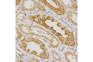 Immunohistochemistry (IHC) image for anti-Interleukin 23 Receptor (IL23R) (AA 405-629) antibody (ABIN3022246)