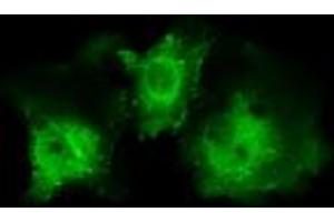 Image no. 1 for anti-Pleckstrin (PLEK) antibody (ABIN1500272) (Pleckstrin 抗体)