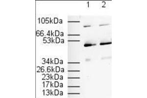 Western Blotting (WB) image for anti-Peroxisome Proliferator-Activated Receptor alpha (PPARA) (N-Term) antibody (ABIN105798)