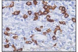 Immunohistochemistry (IHC) image for Mouse anti-Human IgG4 antibody (ABIN952860) (小鼠 anti-人 IgG4 Antibody)