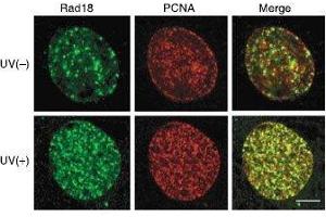 Immunofluorescence (IF) image for anti-E3 ubiquitin-protein ligase RAD18 (RAD18) (C-Term) antibody (ABIN2452086) (RAD18 抗体  (C-Term))