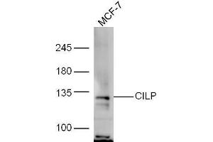 MCF-7 lysate probed with Rabbit Anti-CILP Polyclonal Antibody, Unconjugated  at 1:5000 for 90min at 37˚C. (CILP 抗体  (AA 1051-1184))