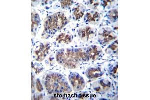 TMM18 Antibody (Center) immunohistochemistry analysis in formalin fixed and paraffin embedded human stomach tissue followed by peroxidase conjugation of the secondary antibody and DAB staining. (Transmembrane Protein 18 (TMM18) (AA 62-90), (Middle Region) 抗体)