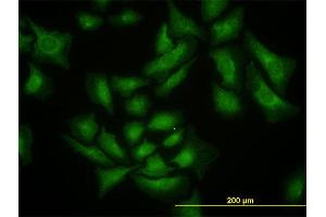 Immunofluorescence (IF) image for anti-SMAD Specific E3 Ubiquitin Protein Ligase 1 (SMURF1) (AA 165-268) antibody (ABIN566098)