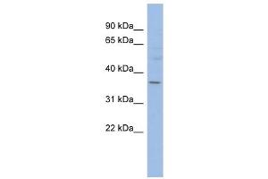HMGCLL1 antibody used at 1 ug/ml to detect target protein. (HMGCLL1 抗体  (N-Term))