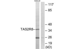 Western blot analysis of extracts from COLO cells, using TAS2R8 antibody. (TAS2R8 抗体  (Internal Region))