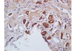 Formalin-fixed and paraffin embedded human kidney labeled with Anti-phospho-MLC(Ser20) /Myosin light chain(Ser20) Polyclonal Antibody, Unconjugated (ABIN872283) at 1:200 followed by conjugation to the secondary antibody and DAB staining (MYL9 抗体  (pSer20))