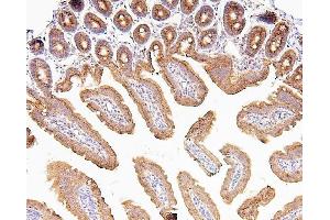 IHC analysis of CDK5 using anti-CDK5 antibody (ABIN6719393). (CDK5 抗体  (AA 1-226))