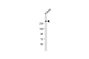 Anti-JMJD1C Antibody (C-Term) at 1:1000 dilution + human brain lysate Lysates/proteins at 20 μg per lane. (JMJD1C 抗体  (AA 2019-2051))