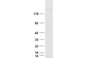 Western Blotting (WB) image for Zinc Finger Protein GLI1 (GLI1) protein (Myc-DYKDDDDK Tag) (ABIN2721923)