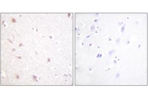 Immunohistochemistry (IHC) image for anti-MKI67 FHA Domain-Interacting Nucleolar Phosphoprotein (MKI67IP) (AA 200-249) antibody (ABIN2888898) (NIFK 抗体  (AA 200-249))