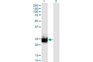 Western Blot analysis of LGALS3 expression in transfected 293T cell line by LGALS3 monoclonal antibody (M03), clone 3G8. (Galectin 3 抗体  (AA 1-250))