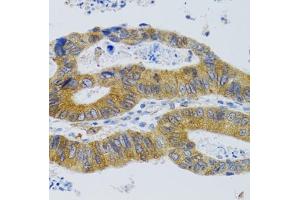 Immunohistochemistry (IHC) image for anti-Mannose-Binding Lectin (Protein C) 2, Soluble (MBL2) (AA 21-248) antibody (ABIN6143597)