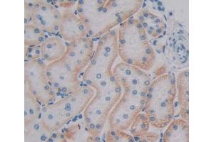 Used in DAB staining on fromalin fixed paraffin- embedded kidney tissue (RAB1A 抗体  (AA 2-205))