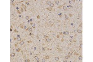 Immunohistochemistry of paraffin-embedded Rat brain using Eif2ak2 Polyclonal Antibody at dilution of 1:200 (40x lens).