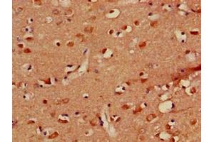 Immunohistochemistry of paraffin-embedded human brain tissue using ABIN7163717 at dilution of 1:100 (PLXND1 抗体  (AA 1-222))