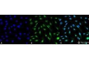 Immunocytochemistry/Immunofluorescence analysis using Mouse Anti-MDC1 Monoclonal Antibody, Clone P2B11 . (MDC1 抗体  (N-Term) (Biotin))