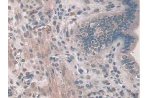 DAB staining on IHC-P; Samples: Mouse Uterus Tissue (PDE12 抗体  (AA 290-602))