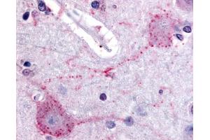 Immunohistochemistry (IHC) image for anti-Proprotein Convertase Subtilisin/kexin Type 6 (PCSK6) (Internal Region) antibody (ABIN213558)