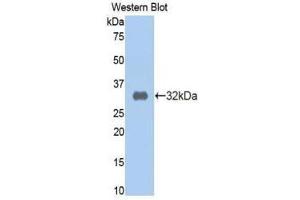 Western Blotting (WB) image for anti-alpha-2-Macroglobulin (A2M) (AA 616-856) antibody (ABIN1077780) (alpha 2 Macroglobulin 抗体  (AA 616-856))