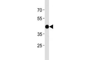 Western Blotting (WB) image for anti-Activating Transcription Factor 4 (Tax-Responsive Enhancer Element B67) (ATF4) (AA 288-314) antibody (ABIN3028447)