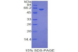 SDS-PAGE (SDS) image for Low Density Lipoprotein Receptor-Related Protein 8, Apolipoprotein E Receptor (LRP8) protein (ABIN3010520)
