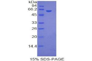 SDS-PAGE analysis of Human LRP8 Protein. (LRP8 蛋白)