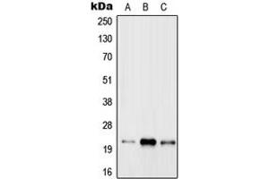 Western blot analysis of RAB31 expression in MCF7 (A), Raw264. (RAB31 抗体  (Center))
