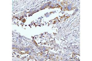 IHC analysis of Glutaminase/GLS using anti-Glutaminase/GLS antibody (ABIN7601601).