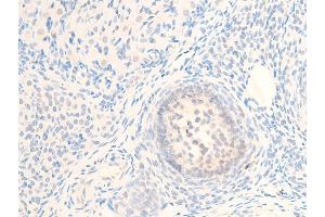 ABIN6267244 at 1/100 staining rat ovarian tissue sections by IHC-P. (MITF 抗体  (pSer73, pSer180))