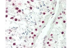 Immunohistochemistry (Paraffin-embedded Sections) (IHC (p)) image for anti-PDS5, Regulator of Cohesion Maintenance, Homolog B (PDS5B) (AA 1400-1447), (C-Term) antibody (ABIN1922759)