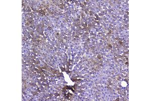 IHC analysis of COX IV using anti-COX IV antibody . (COX IV 抗体  (AA 59-169))
