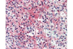Anti-CCL5 / RANTES antibody IHC of human spleen. (CCL5 抗体)