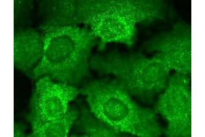 Immunocytochemistry (ICC) image for anti-Calcium Channel, Voltage-Dependent, beta 2 Subunit (CACNB2) (AA 189-205) antibody (Atto 488) (ABIN2485029)