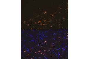 Immunofluorescence analysis of mouse brain cells using GFAP Rabbit pAb (ABIN3020750, ABIN3020751, ABIN3020752, ABIN1512943 and ABIN6213705) at dilution of 1:100 (40x lens). (GFAP 抗体  (C-Term))