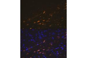 Immunofluorescence analysis of mouse brain cells using GFAP Rabbit pAb (ABIN3020750, ABIN3020751, ABIN3020752, ABIN1512943 and ABIN6213705) at dilution of 1:100 (40x lens). (GFAP 抗体  (C-Term))