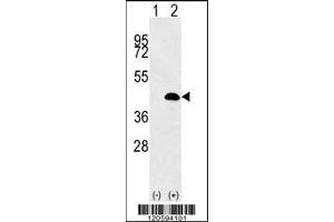 Western blot analysis of LUC7L using rabbit polyclonal LUC7L Antibody using 293 cell lysates (2 ug/lane) either nontransfected (Lane 1) or transiently transfected (Lane 2) with the LUC7L gene. (LUC7L 抗体  (AA 219-246))