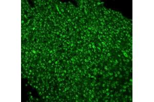 IF analysis of PTBP1 using anti-PTBP1 antibody (ABIN7599450).