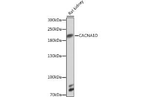 Western blot analysis of extracts of Rat kidney, using CD Rabbit pAb (ABIN7266013) at 1:1000 dilution.