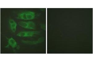 Immunofluorescence analysis of HeLa cells, using Adrenergic Receptor beta2 (Ab-346) Antibody. (beta 2 Adrenergic Receptor 抗体  (AA 321-370))